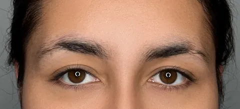 Cejas: antes, recién hecho y cicatrizado · antes