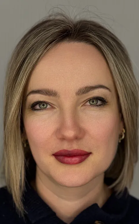Labios: antes, recién hecho y cicatrizado · recién hecho