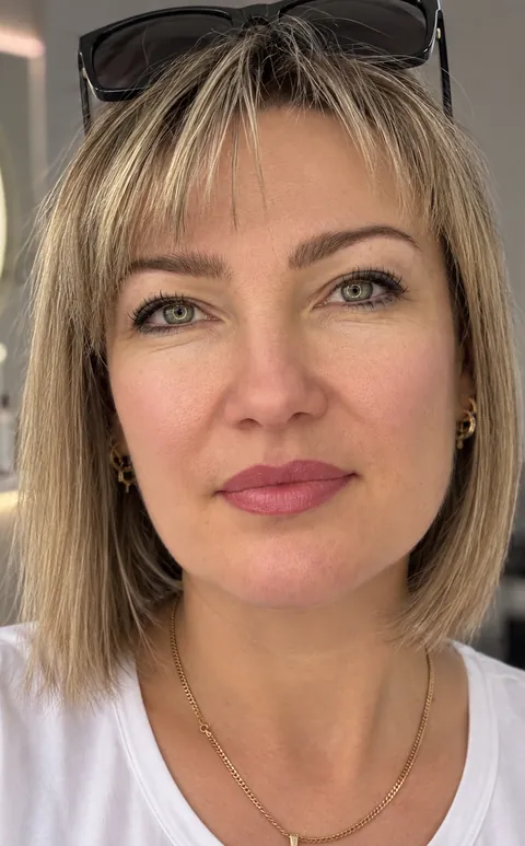 Labios: antes, recién hecho y cicatrizado · cicatrizado