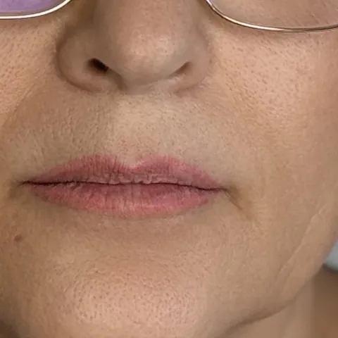 Labios: tono natural · antes