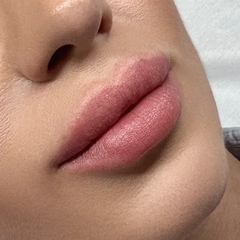 Labios con más volumen visual · antes