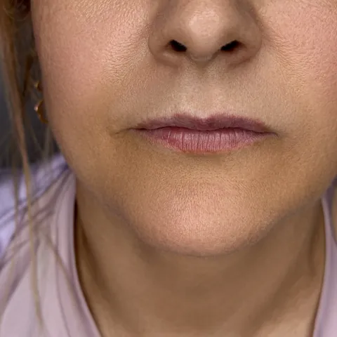 Labios: contorno definido · antes