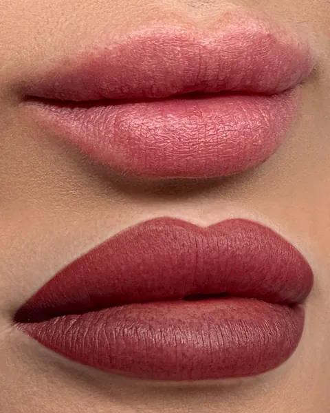 Labios: antes (arriba) y después (abajo): antes arriba, después abajo